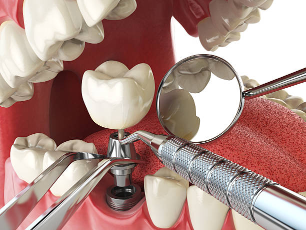 Best Emergency Broken Tooth Repair in Palmview, TX